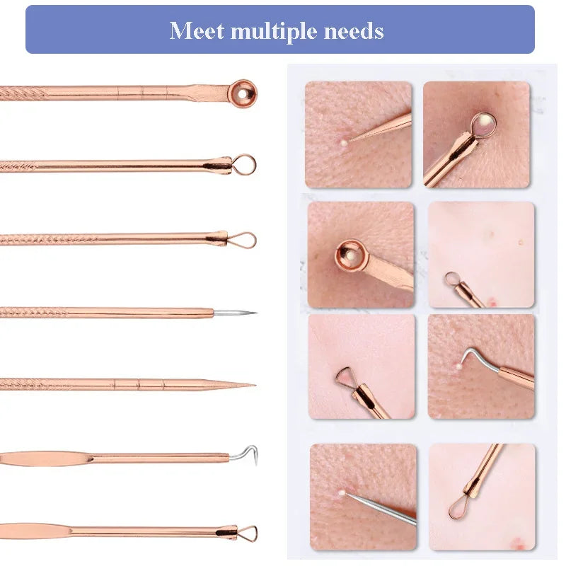 Professional Blackhead Remover Kit