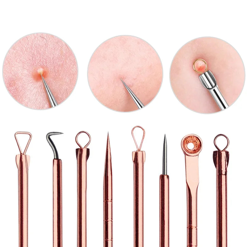 Professional Blackhead Remover Kit